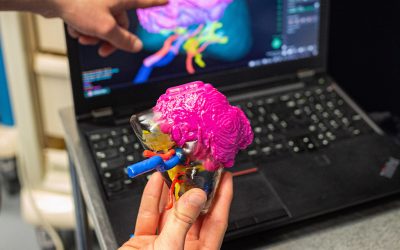 Impression de modèles d’organes sur-mesure | France Innovation