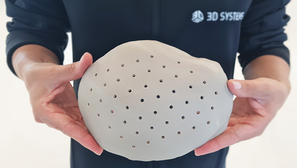 Les hôpitaux européens effectuent des chirurgies crâniennes à l’aide d’implants crâniens imprimés en 3D par 3D Systems