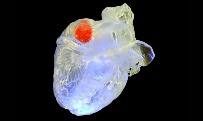 Imprimer en 3D à l’intérieur du corps grâce aux ultrasons