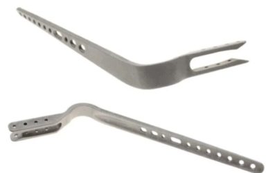 Application du mois : des prothèses d’épaule en titane personnalisées imprimées en 3D