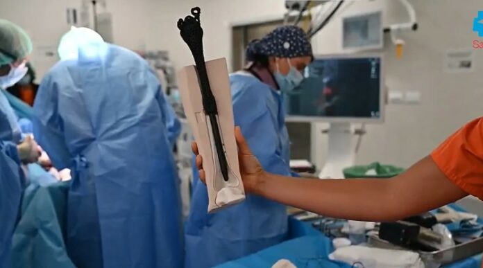 L’impression 3D permet à un hôpital de Madrid d’éviter une amputation de la jambe grâce à un implant osseux en métamatériau